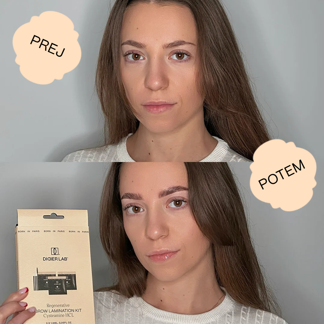 Regenerativni set za laminacijo obrvi "Didier Lab"